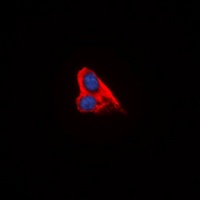 Anti-KEPI Antibody