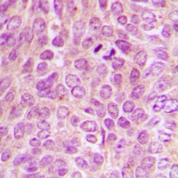 Anti-PKA C alpha/beta/gamma (Phospho-T198) Antibody