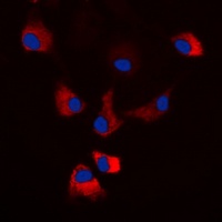 Anti-PKA C alpha/beta/gamma (Phospho-T198) Antibody