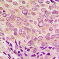 Anti-PKC alpha (Phospho-T638) Antibody