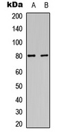 PKC alpha (Phospho-Y658) Antibody