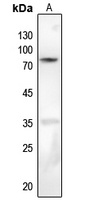 PKC beta (Phospho-S661) Antibody