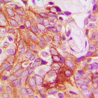 PKC beta (Phospho-S661) Antibody