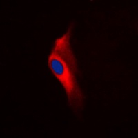 Anti-PKC epsilon (Phospho-S729) Antibody