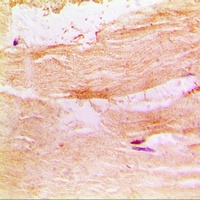 Anti-PKC theta Antibody