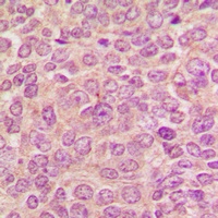 PKC mu Antibody