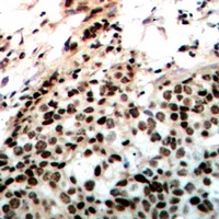 Anti-DNA-PKcs (Phospho-T2647) Antibody