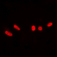 Anti-DNA-PKcs (Phospho-T2647) Antibody