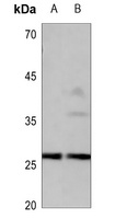 CD201 Antibody