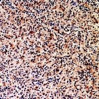 Anti-CD201 Antibody
