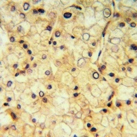 Anti-GPR73a Antibody