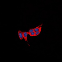 Anti-GPR73a Antibody