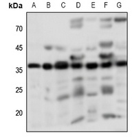 PGD2 Receptor Antibody