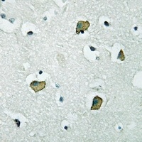 Anti-PGD2 Receptor Antibody