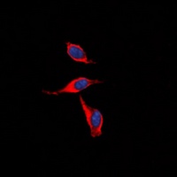 Anti-IP Receptor Antibody