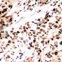 RAD51A (Phospho-Y315) Rabbit Polyclonal Antibody