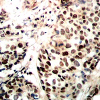 RAD51A Antibody