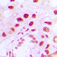 Anti-RAD51D Antibody