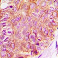 Anti-c-RAF Antibody
