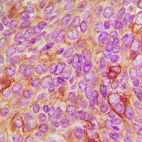 Anti-c-Raf/B-RAF (Phospho-T491/599) Antibody