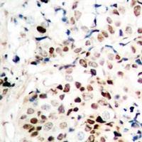 Anti-CTIP Antibody
