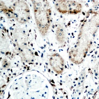 Anti-RBP5 Antibody