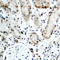 RBP5 antibody