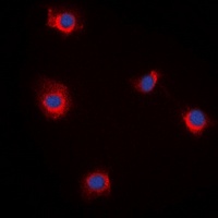 Anti-RBP5 Antibody