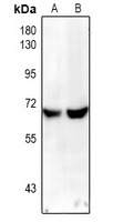 NF-kappaB p65 Antibody