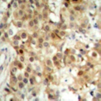NF-kappaB p65 antibody