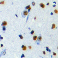 Anti-DNA Polymerase zeta Antibody