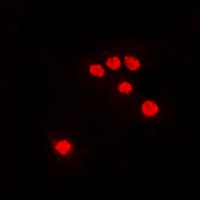 DNA Polymerase zeta antibody