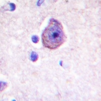 Rhodopsin Rabbit Polyclonal Antibody