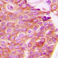 Anti-RhoA Antibody