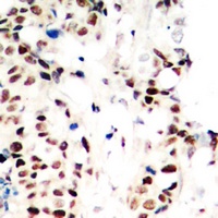 Anti-RPA2 (Phospho-T21) Antibody