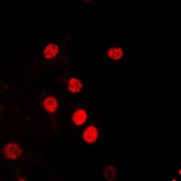 Anti-RPA2 (Phospho-T21) Antibody
