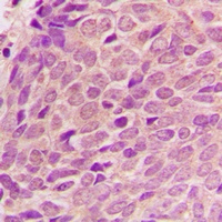 Anti-RPL12 Antibody