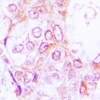 Anti-RSK1/2/3 (Phospho-T573/570/577) Antibody