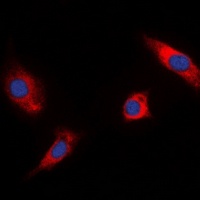 RSK1/2/3 (Phospho-T573/570/577) antibody