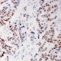 MSK1 Antibody
