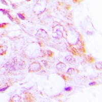 Anti-S6K1 (Phospho-T229) Antibody
