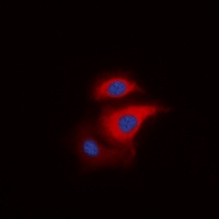S6K1 (Phospho-T229) antibody