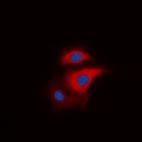 Anti-S6K1 (Phospho-T229) Antibody