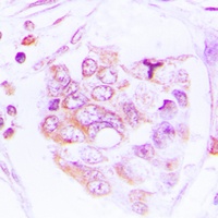 Anti-S6K1 (Phospho-T412) Antibody