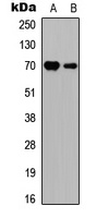S6K1 Rabbit Polyclonal Antibody