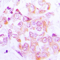 S6K1 Rabbit Polyclonal Antibody