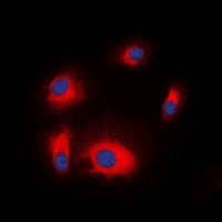 S6K1 Rabbit Polyclonal Antibody