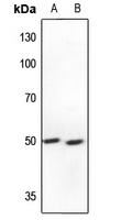 S6K2 Rabbit Polyclonal Antibody