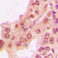 S6K2 Rabbit Polyclonal Antibody