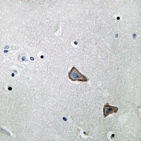 Anti-Secretin Receptor Antibody